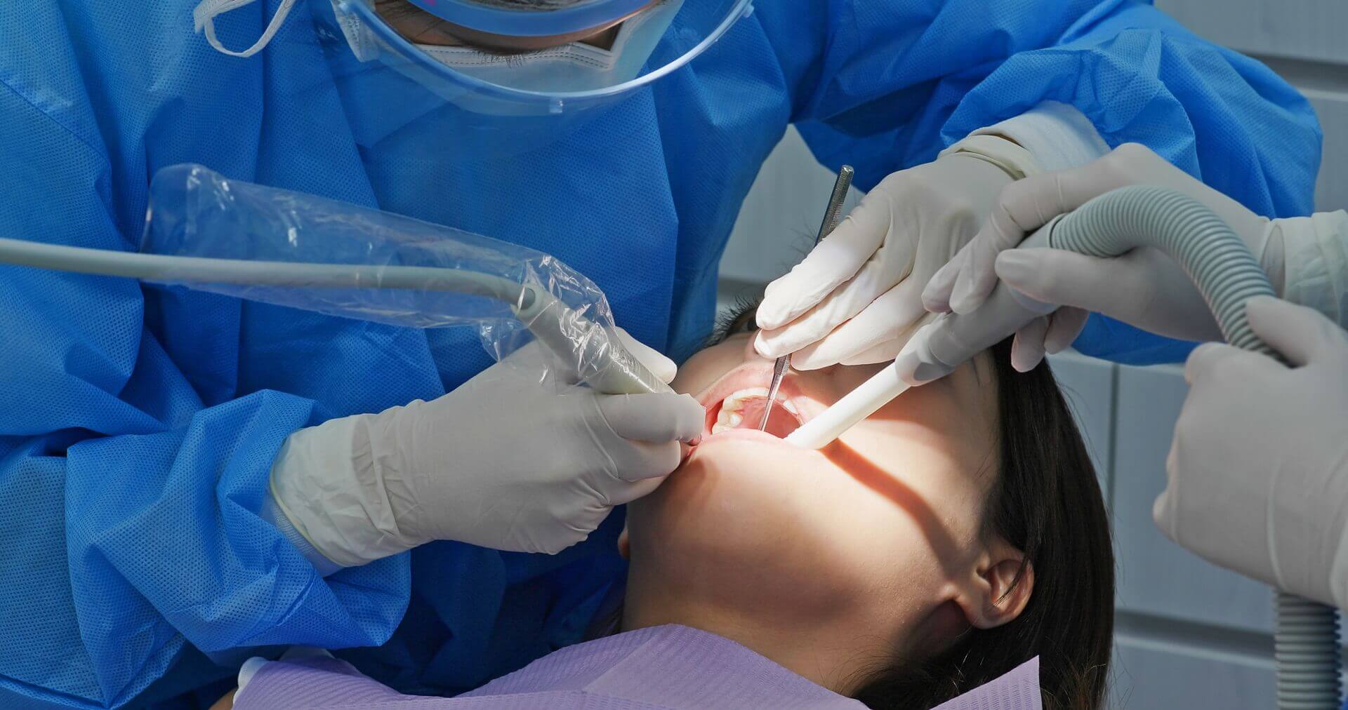 wisdom-tooth-04